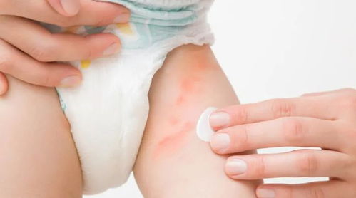 央视点名 这种药品长期用危害大,别随便给宝宝用 你家可能就有